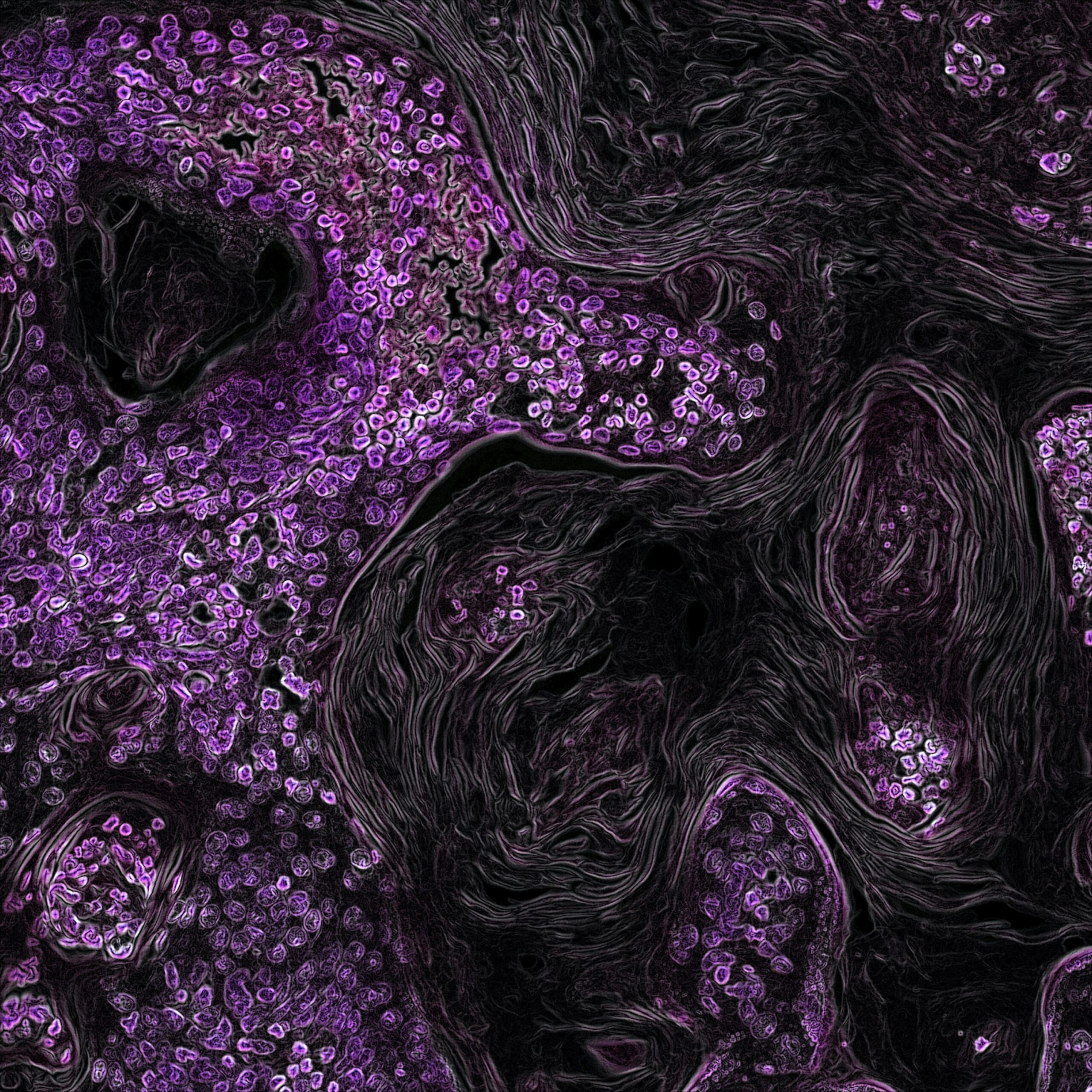 Oncology